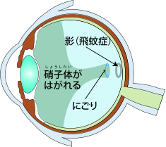 㕔Ɏq̔