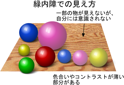 Γł̌