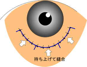 グĖD
